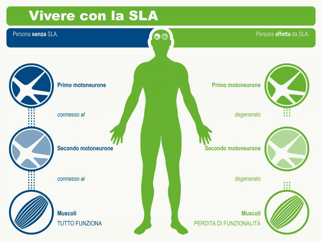 infografica AISLA vivere con la SLA